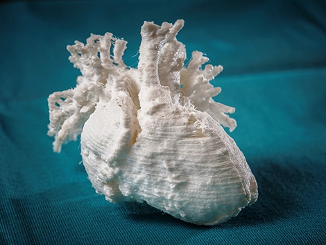 Uniek in Nederland: Baby geopereerd met behulp van geprint 3D-hartmodel
