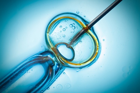 IVF-behandeling: zaadcel wordt in eicel geplant