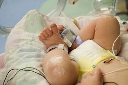 Baby in het ziekenhuis aan het infuus 
