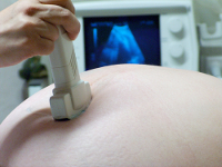 Dossier echo maken tijdens zwangerschap